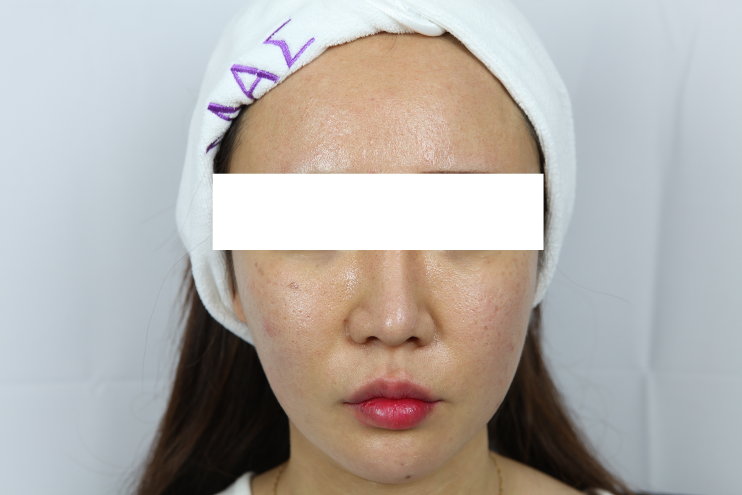 Wicked Snow White Before scaled