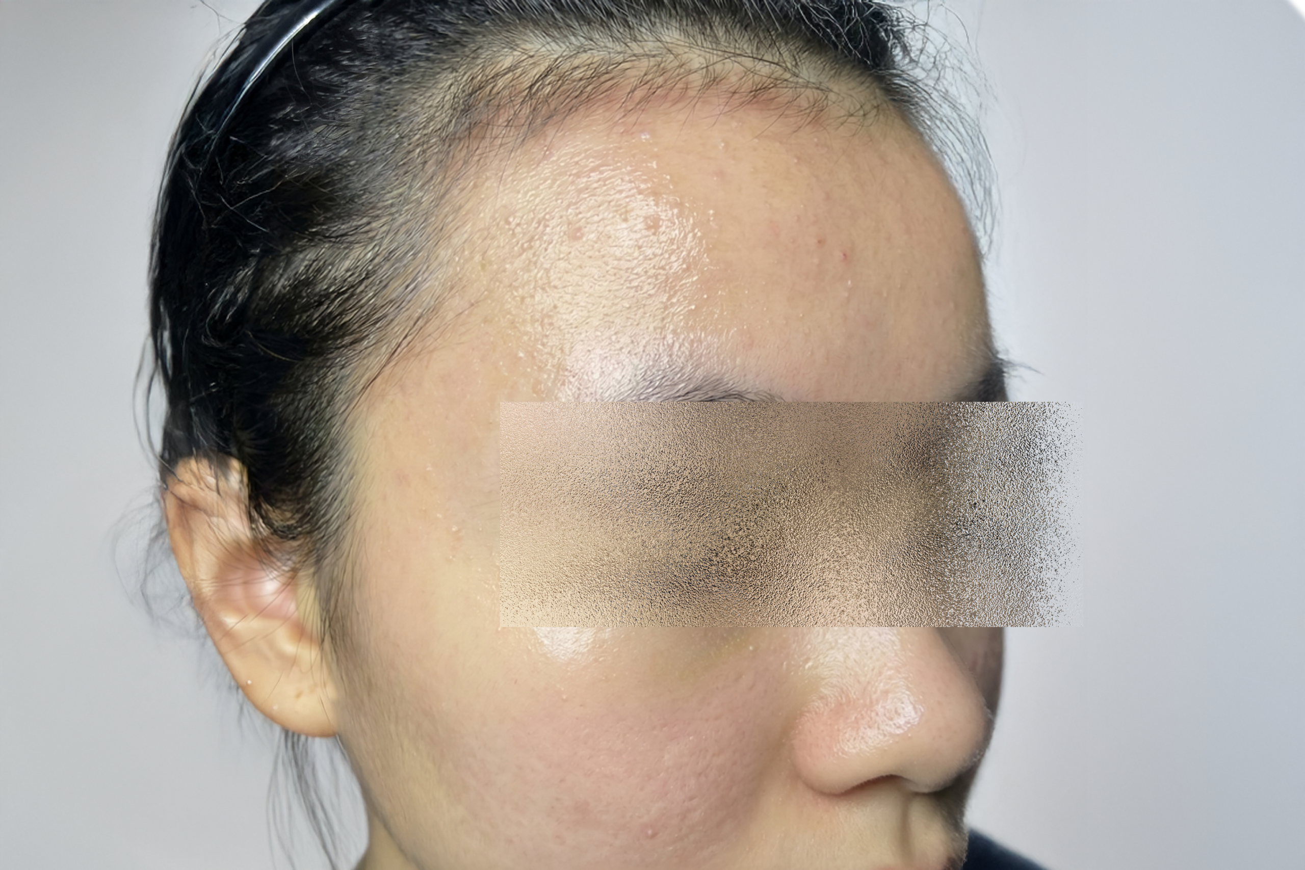 Case 2 Excellus After scaled