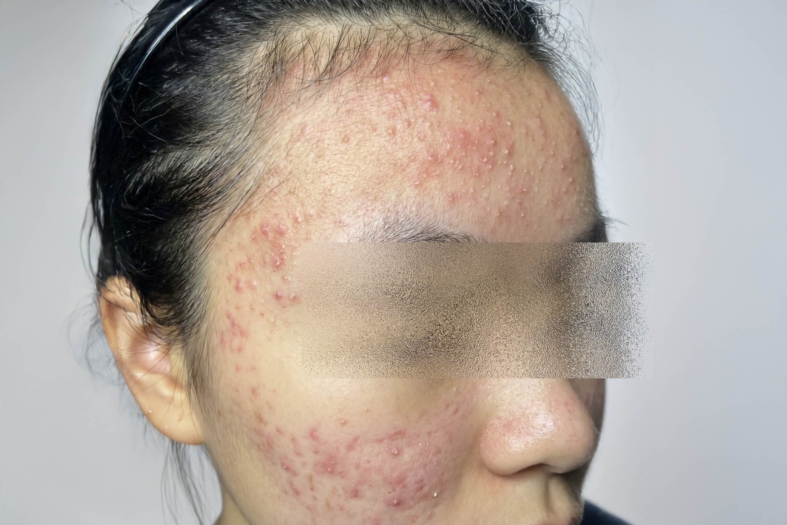 Case 2 Excellus Before scaled
