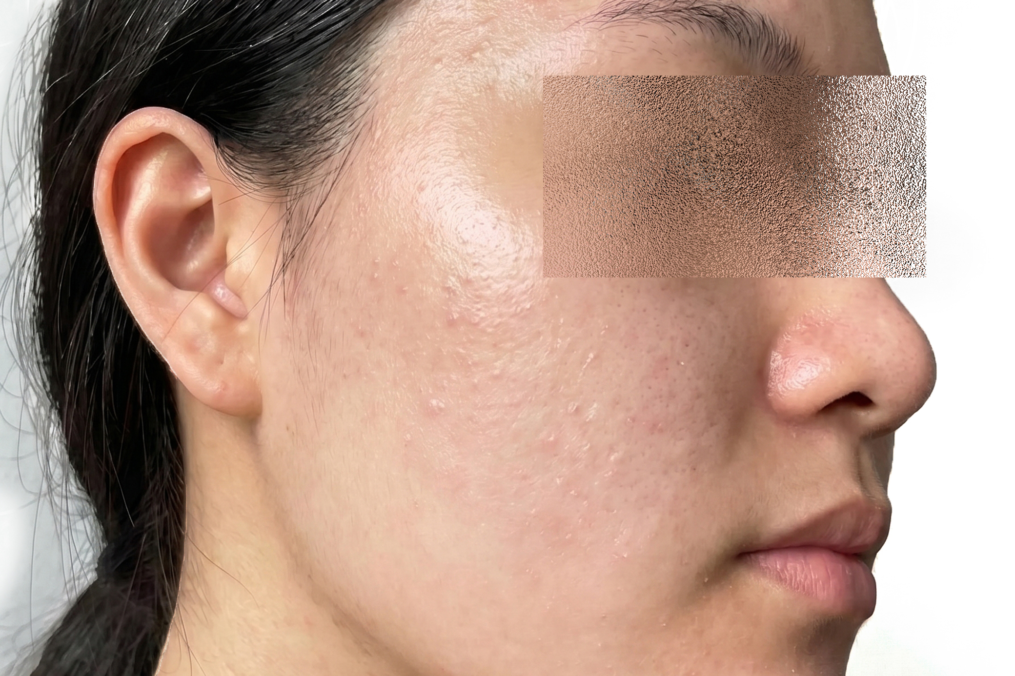 Case 3 Excellus After
