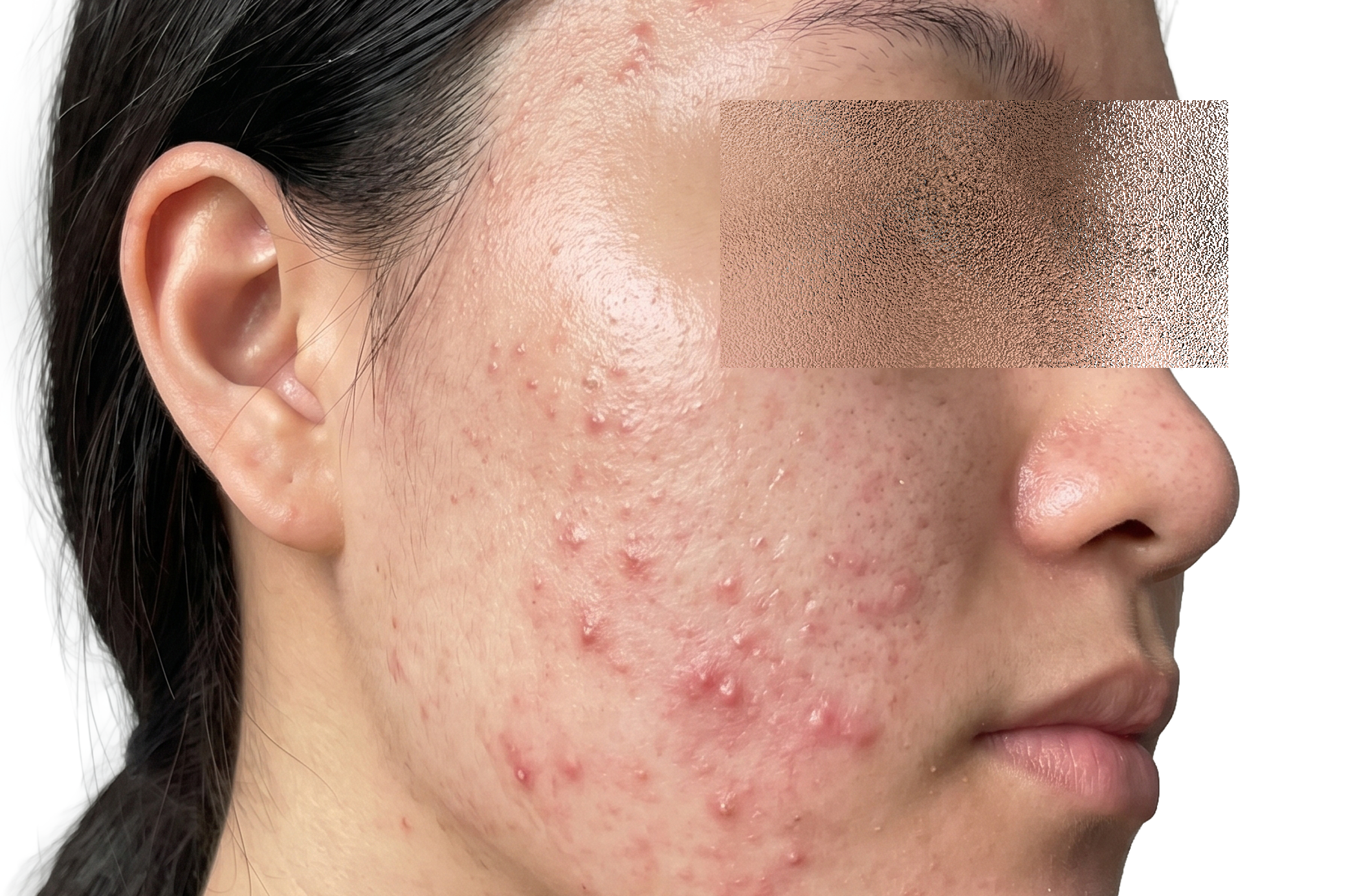 Case 3 Excellus before